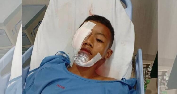 Warganet Bergerak Cari Keluarga Korban Kecelakaan, Pelajar Sekolah Dasar Dirawat Intensif di Rumah Sakit Batam